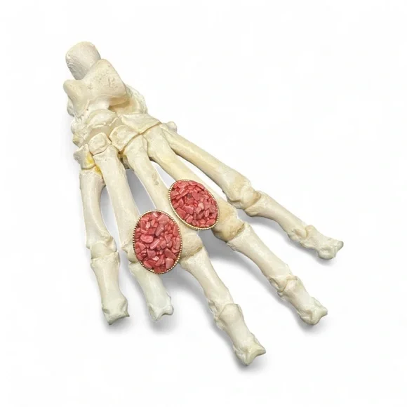 Vintage Art Deco Gold Plated Coral Clip Earrings 1.25” - Picture 4 of 4